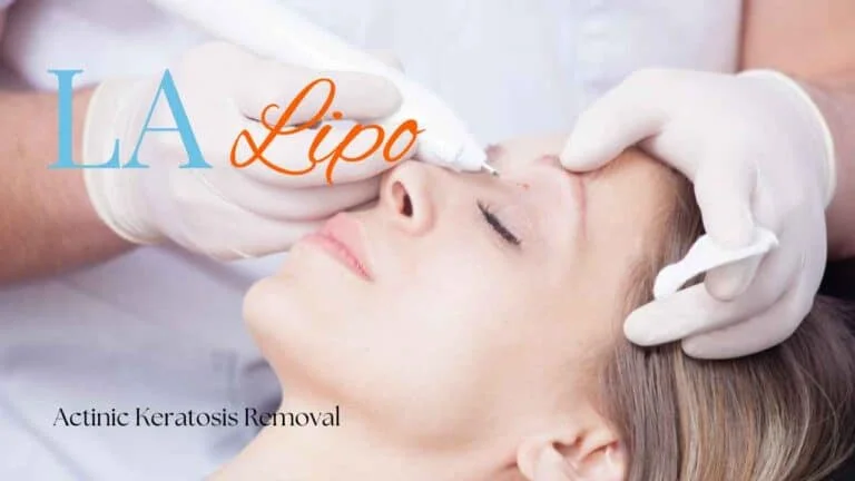 Woman receiving Actinic Keratosis Removal Treatment Windlesham