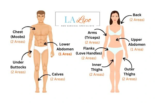 LA LIPO Cryolipolysis Areas Windlesham