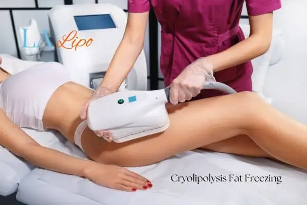 Woman receiving coolsculpting Windlesham treatment on her thighs