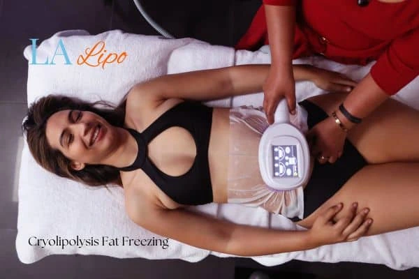 woman getting cryolipolysis Windlesham