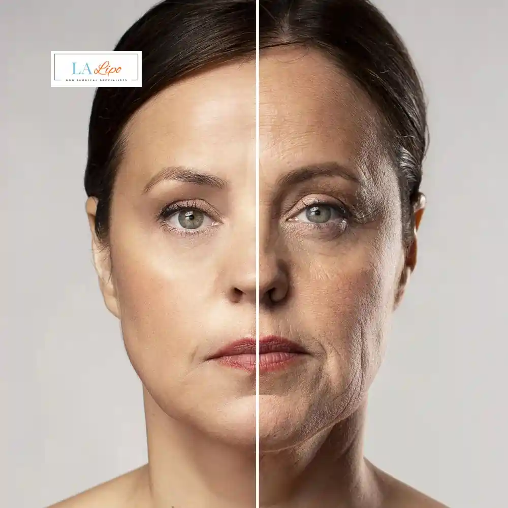 How Can You Tell If Non-Surgical Skin Tightening Is Right for You Windlesham?