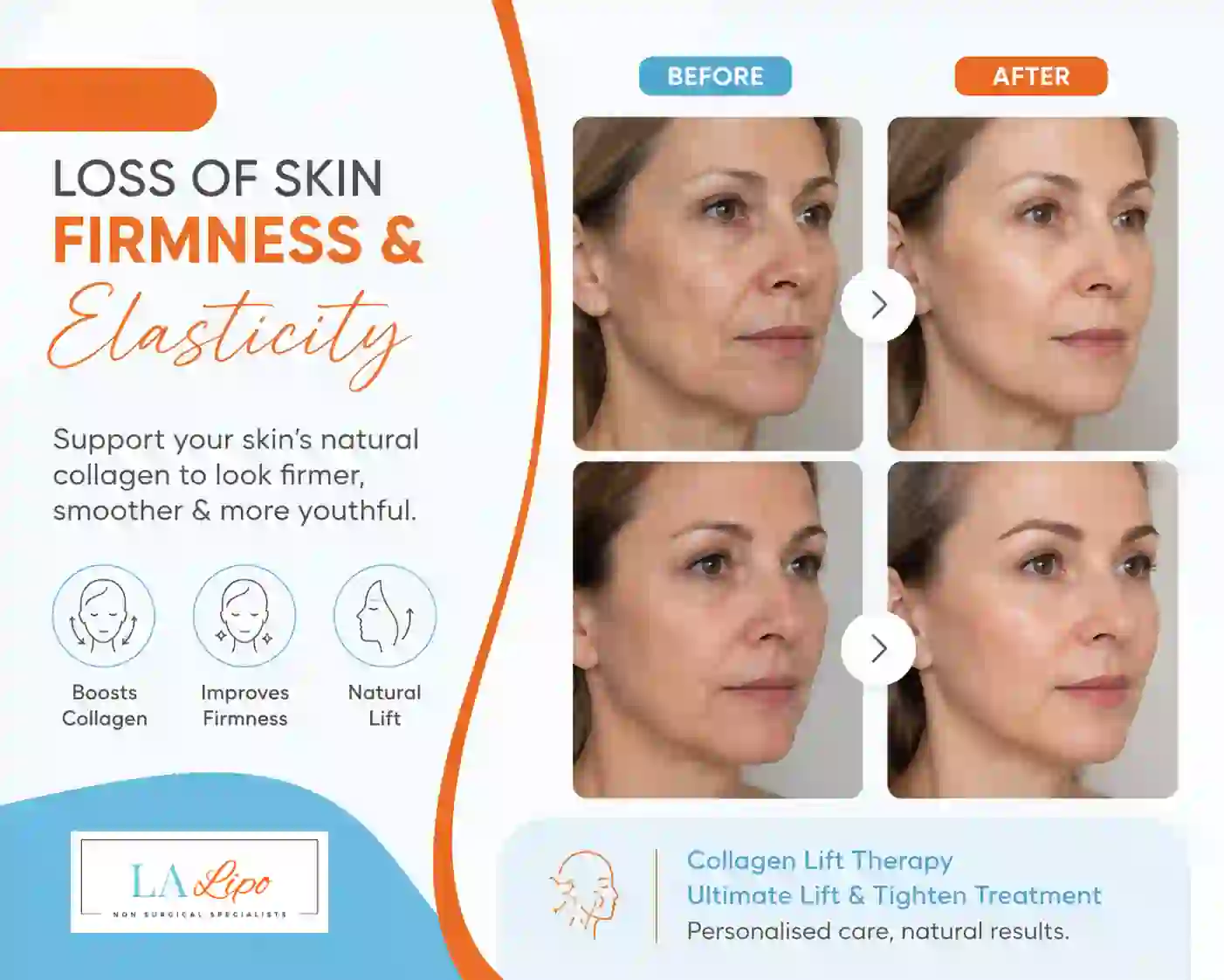 Sign #7: Loss of Skin Firmness and Elasticity Windlesham