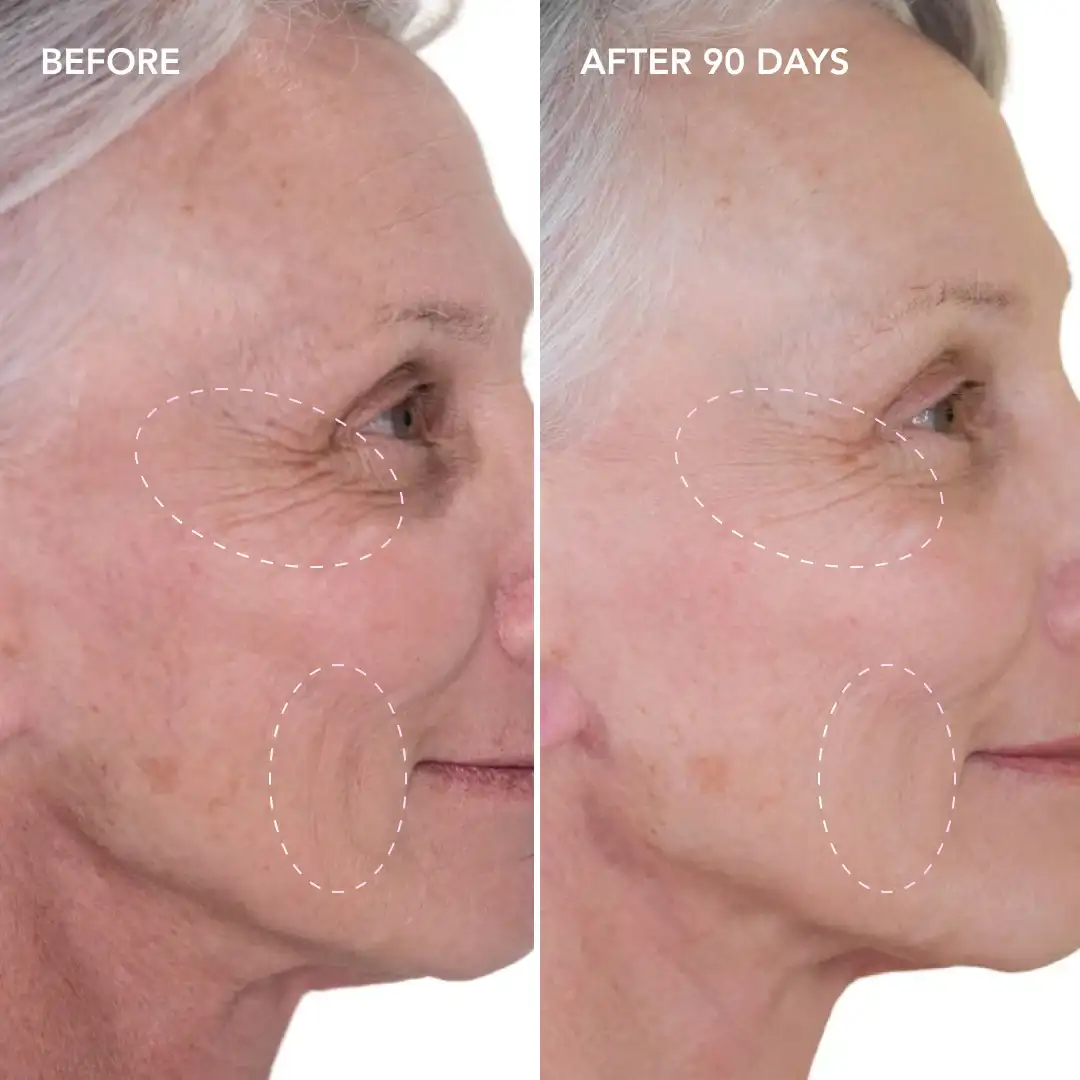 When will you see results Windlesham